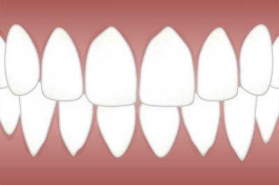 implant dentaire paris